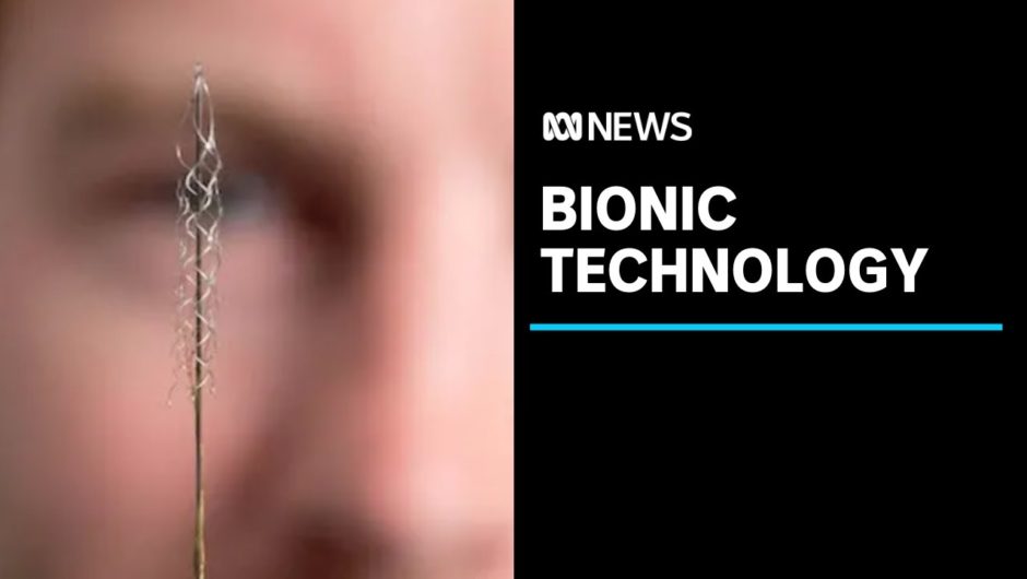 Bionic breakthrough allows people with paralysis to control computers with thoughts | ABC News