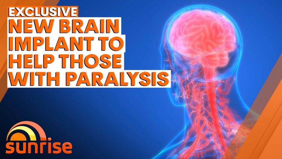 New Stendrode brain implant allows paralysed people to control a computer with thoughts | 7NEWS