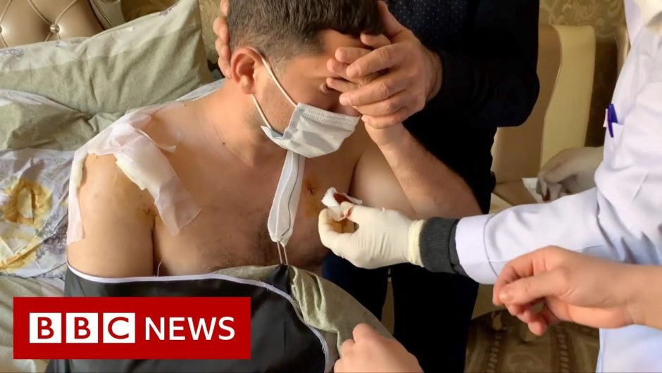 Life after war: 'It's too painful to sleep' – BBC News