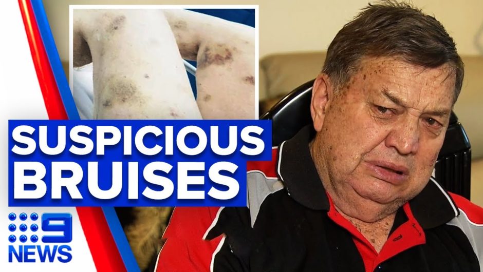 Bruises found on wife during nursing home stay | 9 News Australia