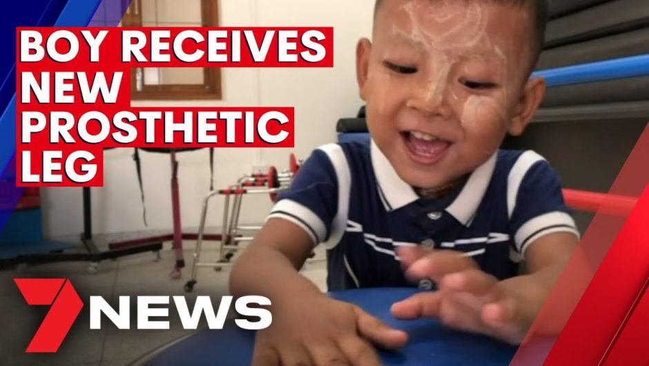 Toddler receives life changing prosthetic leg | 7NEWS