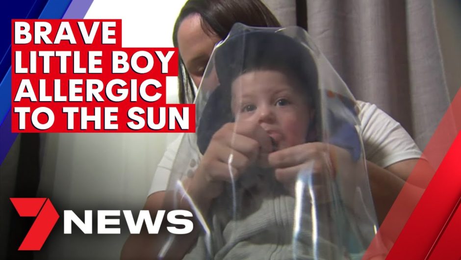 Brave little boy allergic to the sun | 7NEWS