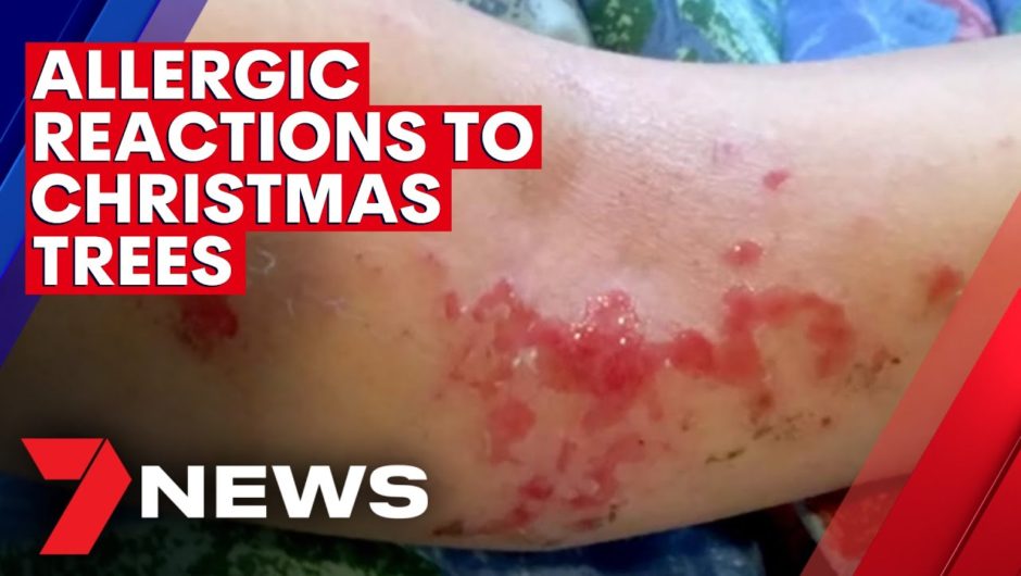 Allergic reactions to real Christmas trees | 7NEWS