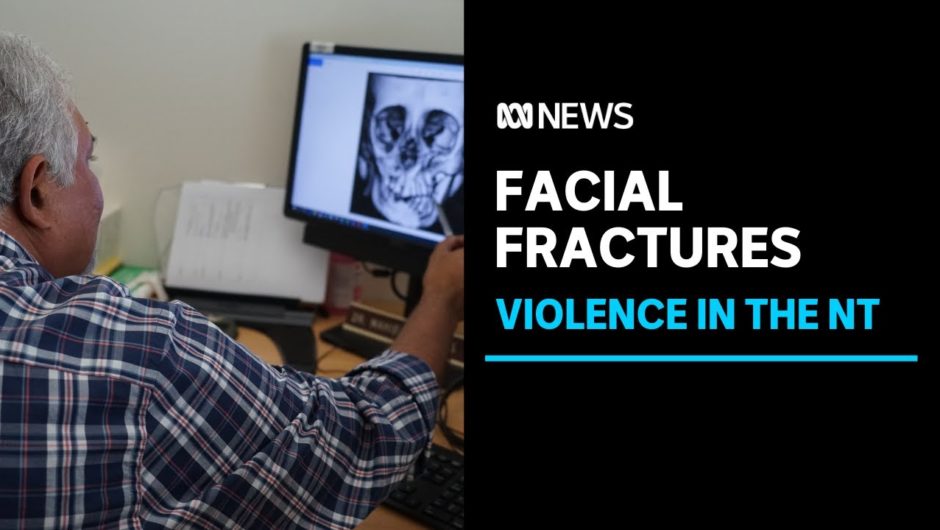 Meet the facial surgeon treating the victims of trauma and violence across the NT | ABC News