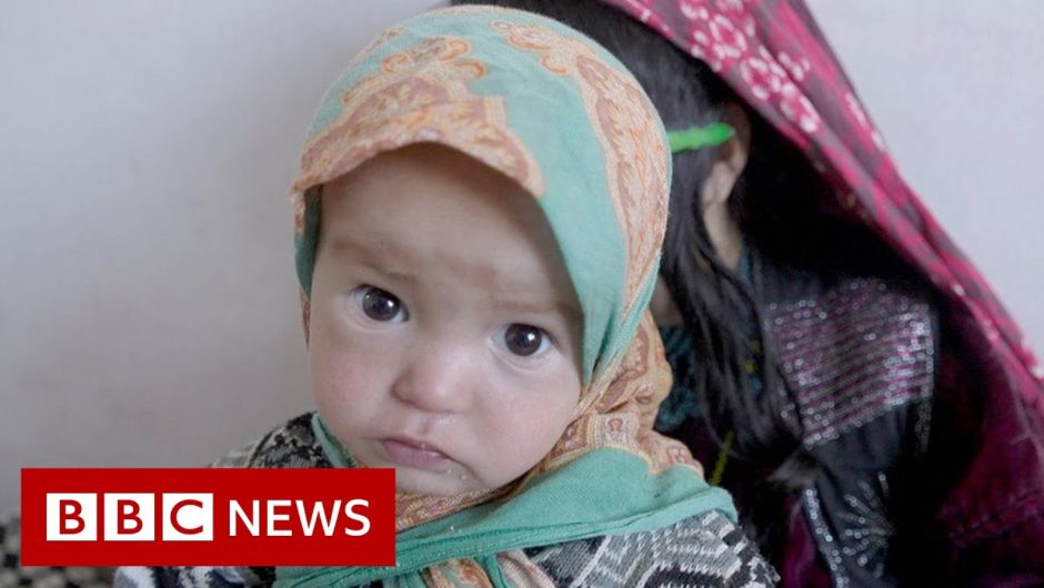 Afghan children battle malnutrition and measles as 23m face extreme hunger – BBC News